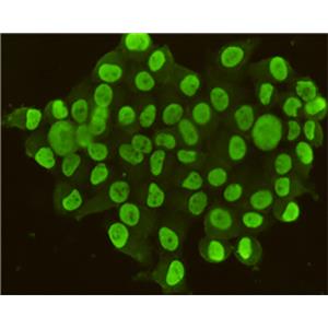 CDX2 (4F12)鼠单抗,CDX2 (4F12) Mouse Monoclonal Antibody
