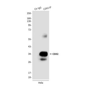 CDX2 (4F12)鼠单抗,CDX2 (4F12) Mouse Monoclonal Antibody