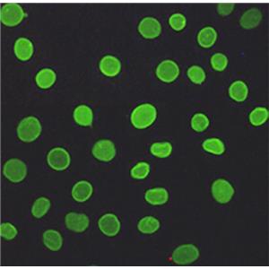 Lamin A/C (5D12)鼠单抗,Lamin A/C (5D12) Mouse Monoclonal Antibody