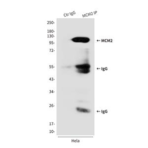 MCM2 (2B5)鼠单抗,MCM2 (2B5) Mouse Monoclonal Antibody
