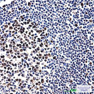 MCM2 (2B5)鼠单抗,MCM2 (2B5) Mouse Monoclonal Antibody