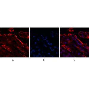 Galectin 3 (4B2)鼠单抗,Galectin 3 (4B2) Mouse Monoclonal Antibody