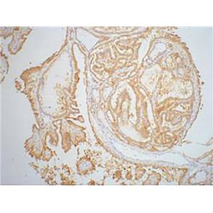 Galectin 3 (4B2)鼠单抗,Galectin 3 (4B2) Mouse Monoclonal Antibody