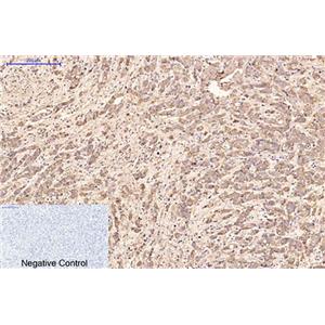 AFP alpha 1 Fetoprotein(17C5)鼠单抗,AFP alpha 1 Fetoprotein(17C5)Mouse Monoclonal Antibody