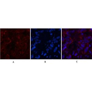 AFP alpha 1 Fetoprotein(17C5)鼠单抗,AFP alpha 1 Fetoprotein(17C5)Mouse Monoclonal Antibody