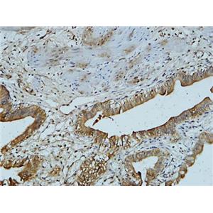 AFP alpha 1 Fetoprotein(17C5)鼠单抗,AFP alpha 1 Fetoprotein(17C5)Mouse Monoclonal Antibody