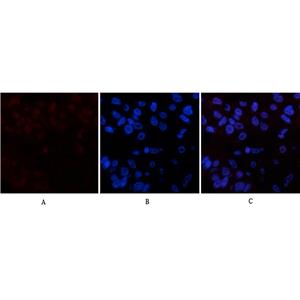 Cleaved PARP(Mix)鼠单抗,Cleaved PARP(Mix)Mouse Monoclonal Antibody
