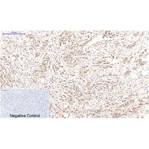 Cleaved PARP(Mix)鼠单抗,Cleaved PARP(Mix)Mouse Monoclonal Antibody