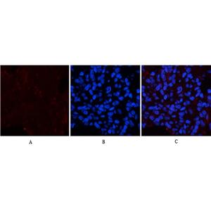 Collagen IV(8E5)鼠单抗,Collagen IV(8E5)Mouse Monoclonal Antibody