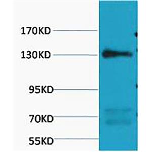 eNOS(Mix)鼠单抗,eNOS(Mix)Mouse Monoclonal Antibody