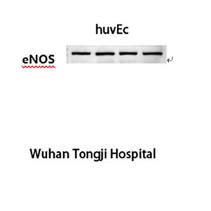 eNOS(Mix)鼠单抗,eNOS(Mix)Mouse Monoclonal Antibody