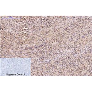 FH(7F1)鼠单抗,FH(7F1)Mouse Monoclonal Antibody