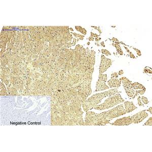 FH(7F1)鼠单抗,FH(7F1)Mouse Monoclonal Antibody