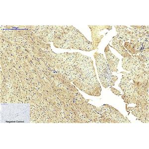 FH(7F1)鼠单抗,FH(7F1)Mouse Monoclonal Antibody