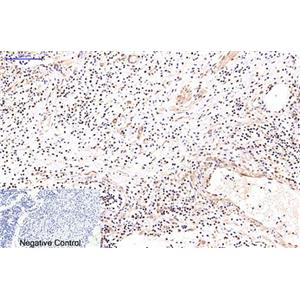 NFkB p65(5G6)鼠单抗,NFkB p65(5G6)Mouse Monoclonal Antibody