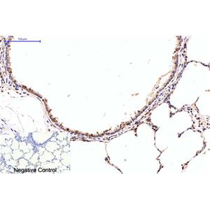NFkB p65(5G6)鼠单抗,NFkB p65(5G6)Mouse Monoclonal Antibody