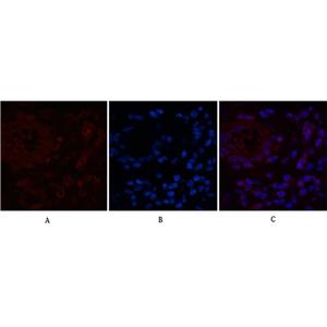 NFkB p65(5G6)鼠单抗,NFkB p65(5G6)Mouse Monoclonal Antibody