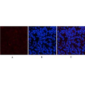 PDGFRα(7A3)鼠单抗,PDGFRα(7A3)Mouse Monoclonal Antibody