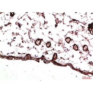 PDGFRα(7A3)鼠单抗,PDGFRα(7A3)Mouse Monoclonal Antibody