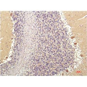 SGK1(4D12)鼠单抗,SGK1(4D12)Mouse Monoclonal Antibody