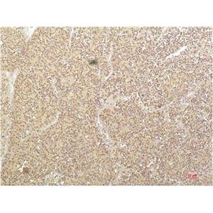 SGK1(4D12)鼠单抗,SGK1(4D12)Mouse Monoclonal Antibody