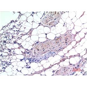 Smad3(4C9)鼠单抗,Smad3(4C9)Mouse Monoclonal Antibody