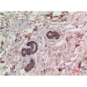 Smad3(4C9)鼠单抗,Smad3(4C9)Mouse Monoclonal Antibody