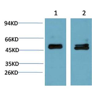 Smad3(4C9)鼠单抗,Smad3(4C9)Mouse Monoclonal Antibody
