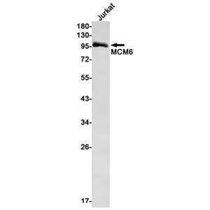 MCM6兔单抗,MCM6 Rabbit Monoclonal Antibody