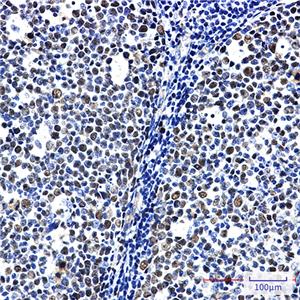 MCM6兔单抗,MCM6 Rabbit Monoclonal Antibody