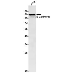 E Cadherin兔单抗,E Cadherin Rabbit Monoclonal Antibody