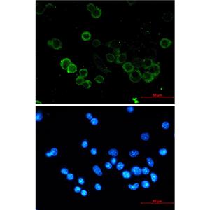 E Cadherin兔单抗,E Cadherin Rabbit Monoclonal Antibody
