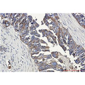 E Cadherin兔单抗,E Cadherin Rabbit Monoclonal Antibody