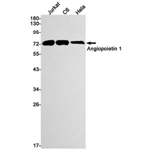 Angiopoietin 1兔单抗,Angiopoietin 1 Rabbit Monoclonal Antibody