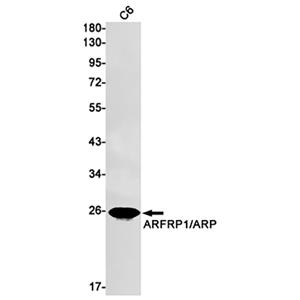 ARFRP1兔单抗,ARFRP1 Rabbit Monoclonal Antibody