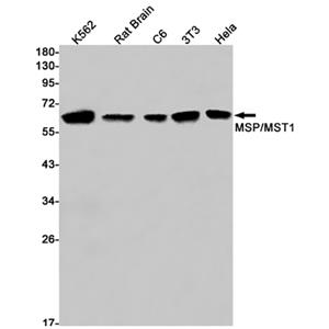 MSP兔单抗,MSP Rabbit Monoclonal Antibody