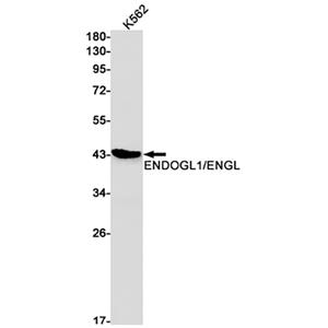 ENDOGL1兔单抗,ENDOGL1 Rabbit Monoclonal Antibody