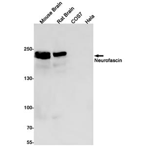 Neurofascin兔单抗,Neurofascin Rabbit Monoclonal Antibody