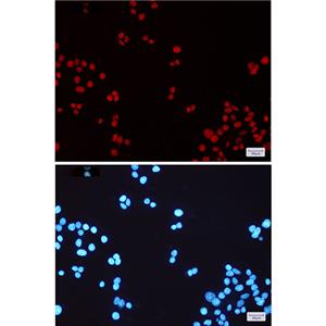 MSH6兔单抗,MSH6 Rabbit Monoclonal Antibody