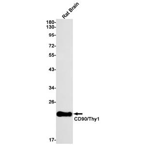CD90兔单抗,CD90 Rabbit Monoclonal Antibody