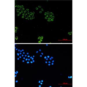 Glypican 1兔单抗,Glypican 1 Rabbit Monoclonal Antibody