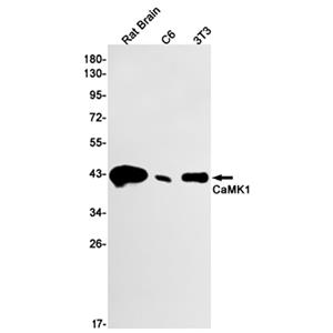 CaMK1兔单抗,CaMK1 Rabbit Monoclonal Antibody