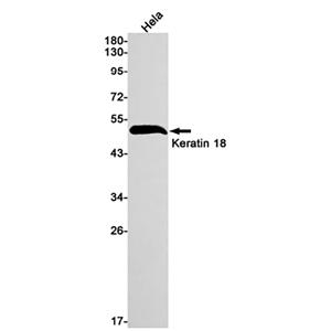Cytokeratin 18兔单抗,Cytokeratin 18 Rabbit Monoclonal Antibody