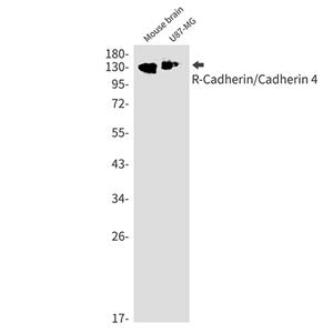 R Cadherin兔单抗,R Cadherin Rabbit Monoclonal Antibody