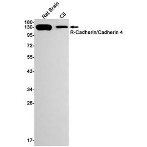 R Cadherin兔单抗,R Cadherin Rabbit Monoclonal Antibody
