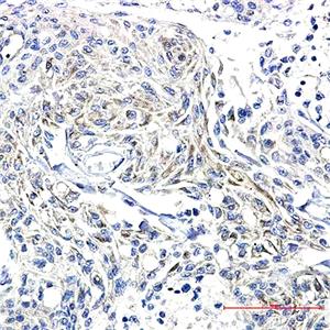 Phospho-Synapsin I (Ser9)兔单抗,Phospho-Synapsin I (Ser9) Rabbit Monoclonal Antibody