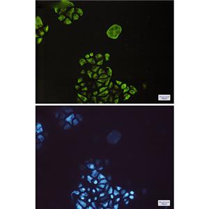 Phospho-GSK3 beta (Ser9)兔单抗,Phospho-GSK3 beta (Ser9) Rabbit Monoclonal Antibody