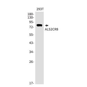 ALS2CR8兔单抗,ALS2CR8 Rabbit Monoclonal Antibody