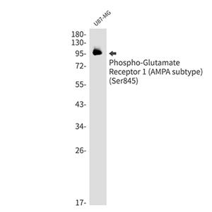 Phospho-Glutamate Receptor 1 (AMPA Subtype) (Ser845)兔单抗,Phospho-Glutamate Receptor 1 (AMPA Subtype) (Ser845) Rabbit Monoclonal Antibody