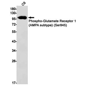 Phospho-Glutamate Receptor 1 (AMPA Subtype) (Ser845)兔单抗,Phospho-Glutamate Receptor 1 (AMPA Subtype) (Ser845) Rabbit Monoclonal Antibody